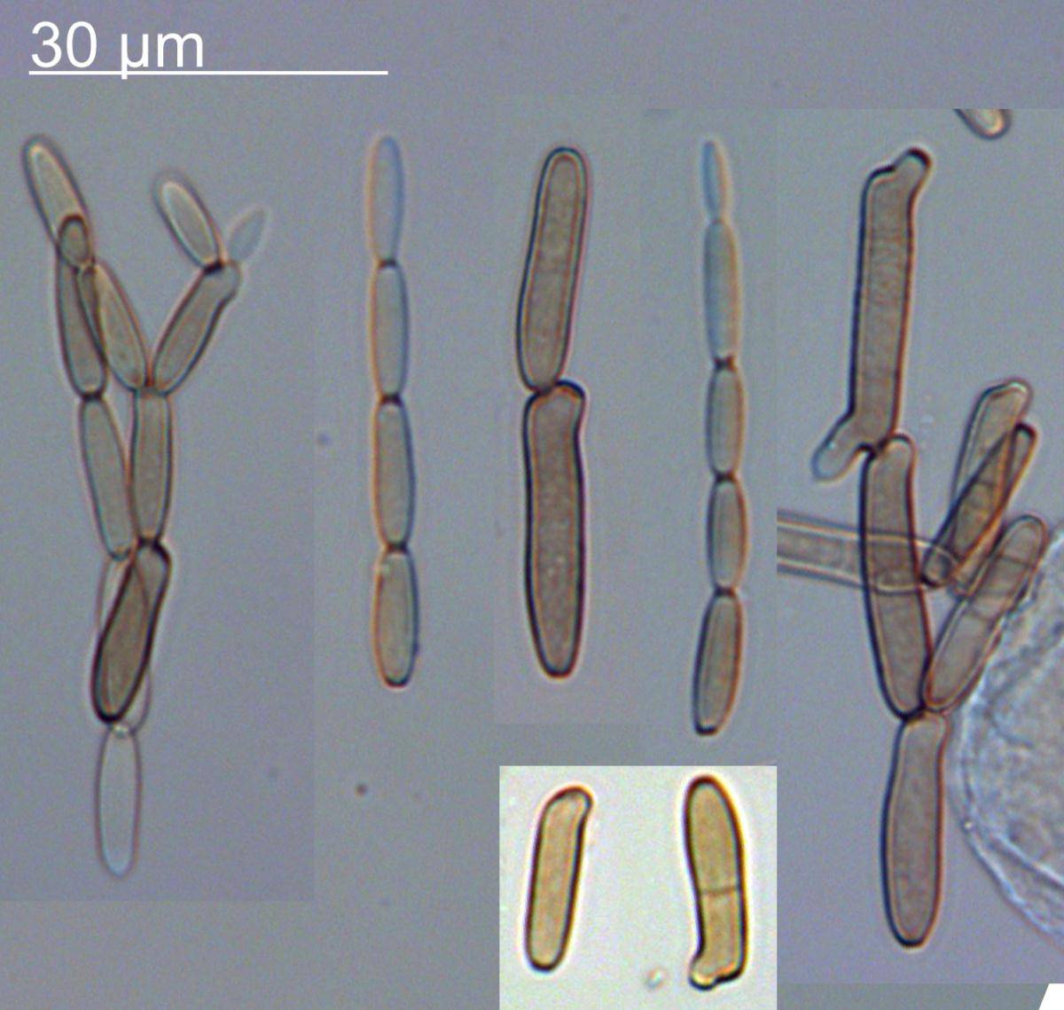 Chalastospora gossypii image