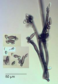 Cladosporium aecidiicola image