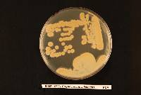 Cryptococcus adeliensis image