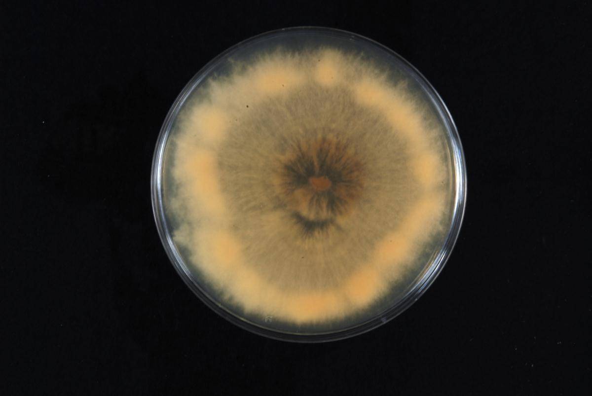 Pestalotiopsis foedans image