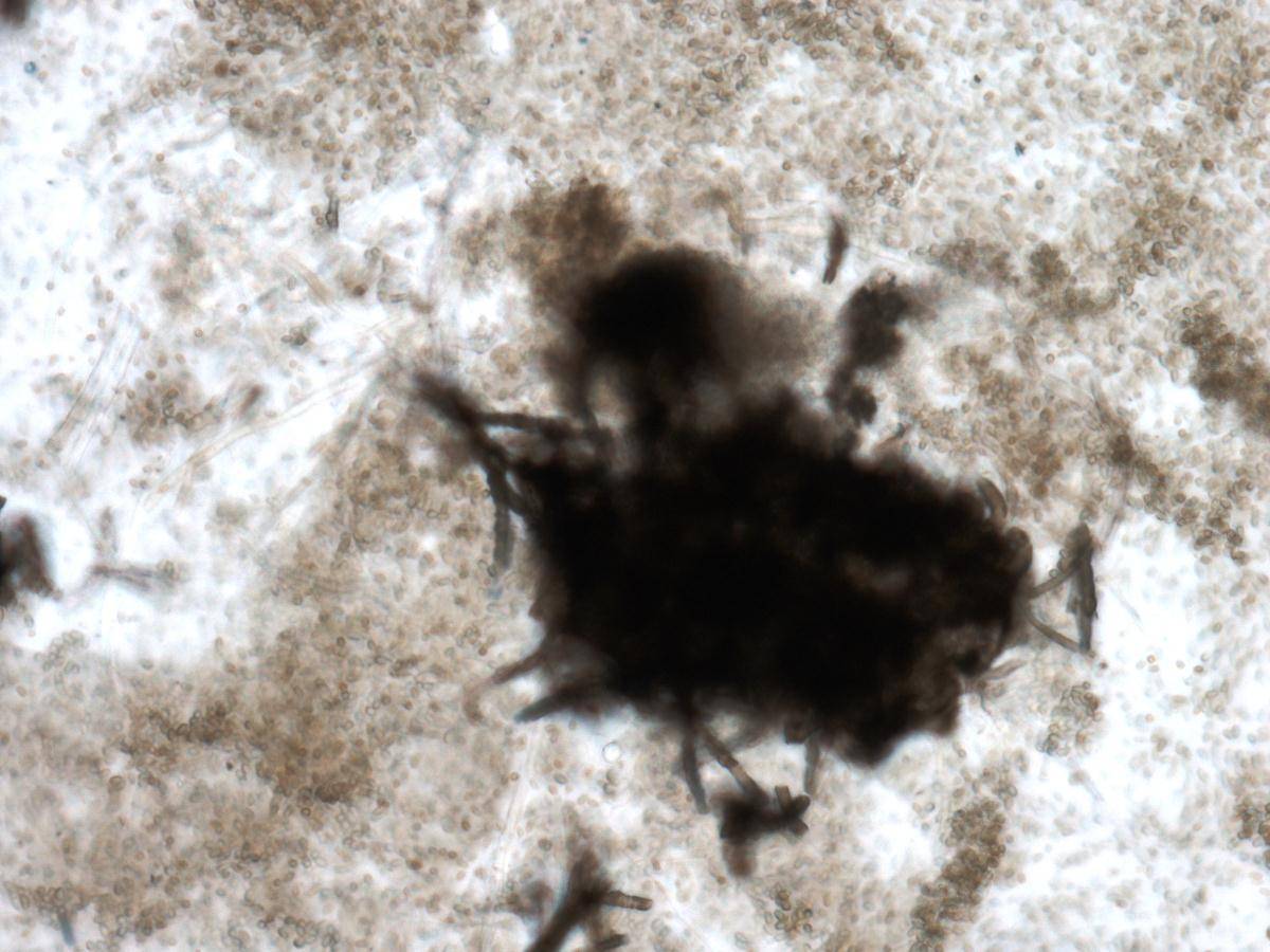 Anthostomella zongluensis image