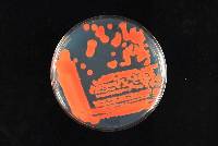 Sporobolomyces ruberrimus image