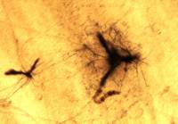 Melanochaeta hemipsila image