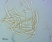 Septoria colensoi image