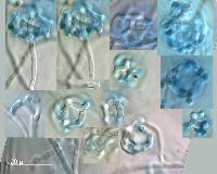 Pseudoclathrosphaerina spiralis image
