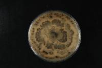 Pestalotiopsis microspora image