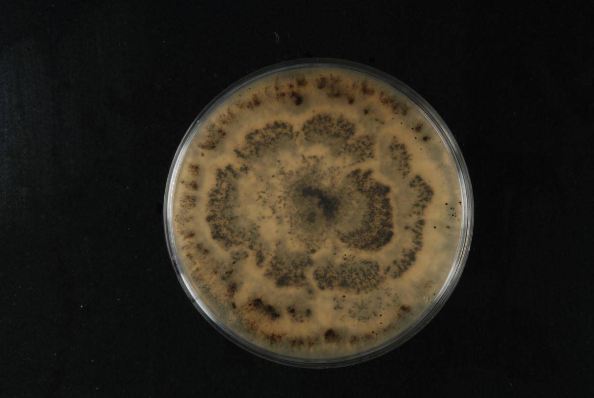 Pestalotiopsis microspora image