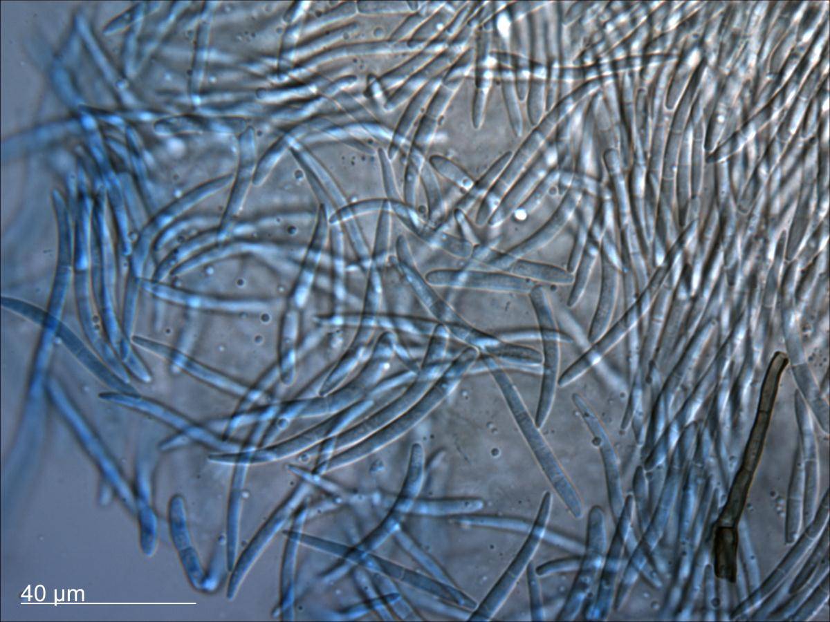 Septoria anaxaea image