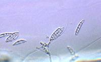 Fusarium acuminatum image