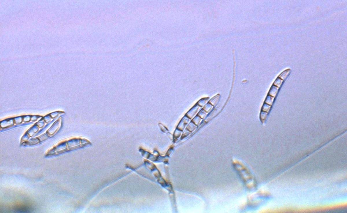 Fusarium acuminatum image