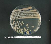 Cryptococcus adeliensis image