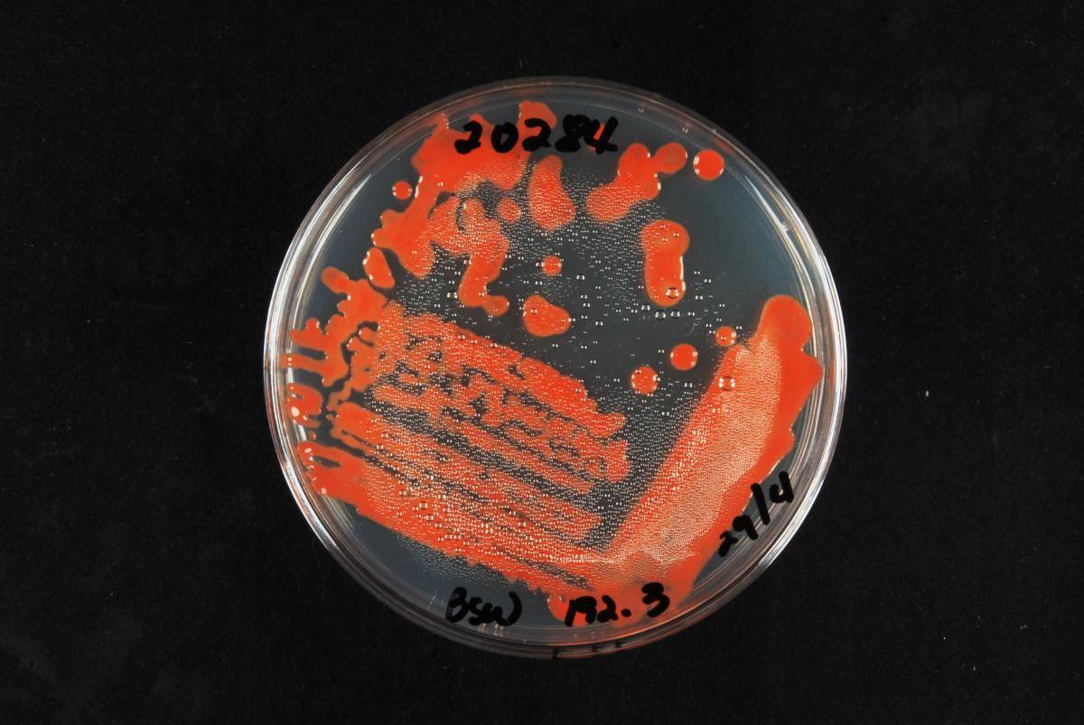 Sporobolomyces ruberrimus image