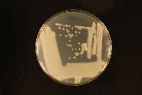 Cryptococcus laurentii image