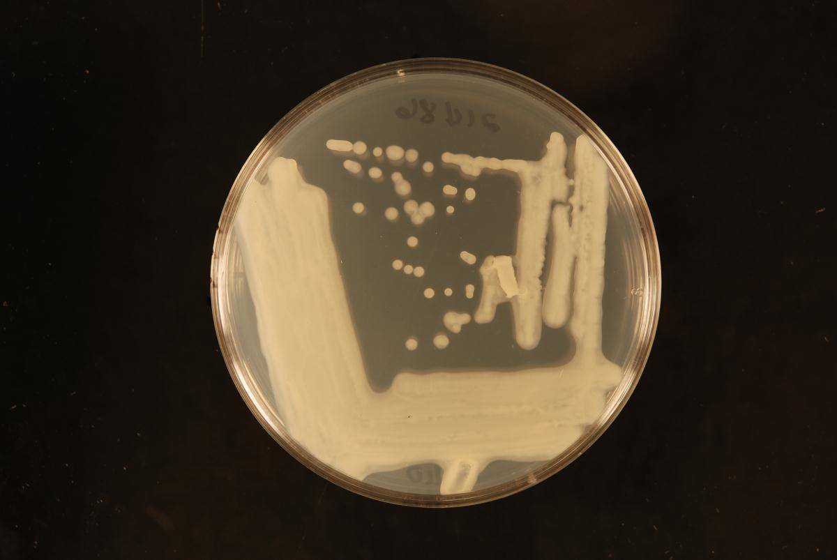 Cryptococcus laurentii image