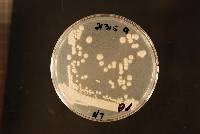 Candida parapsilosis image