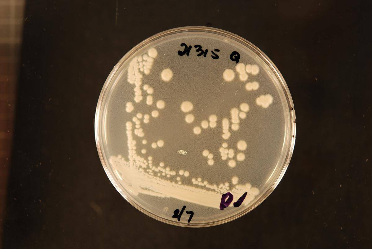 Candida parapsilosis image