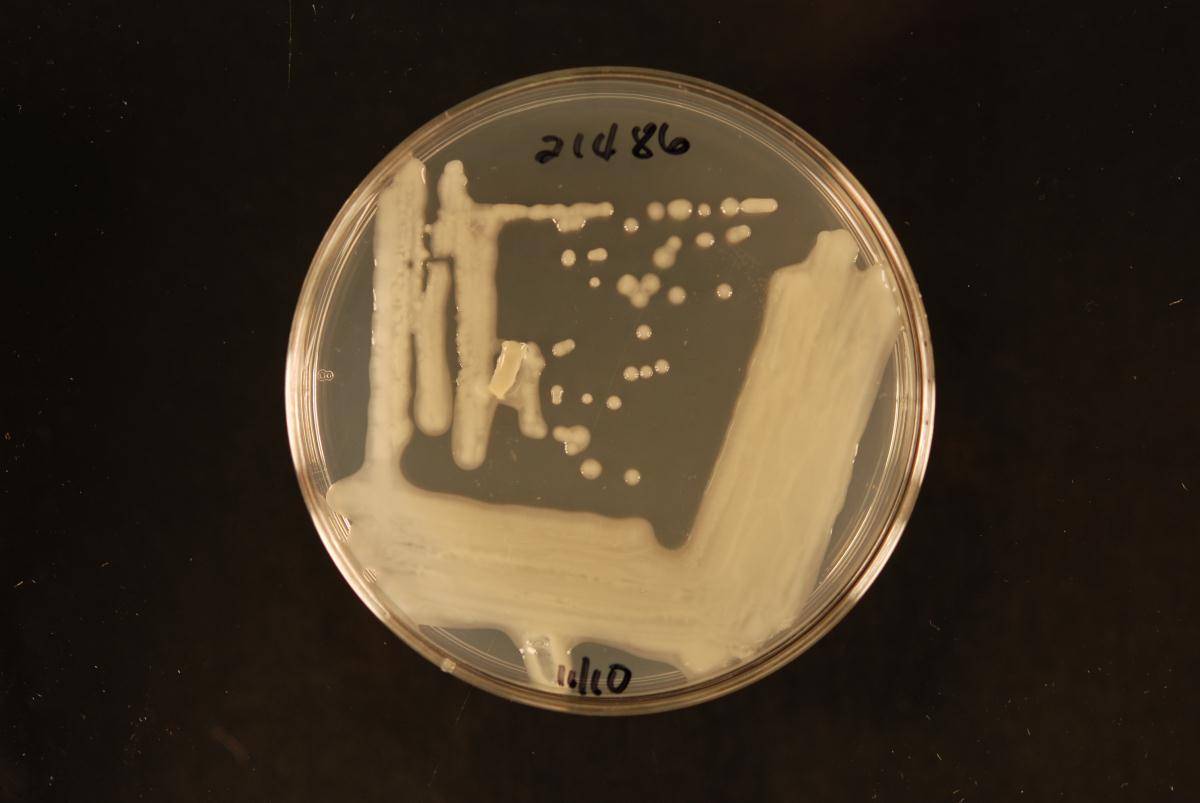 Cryptococcus laurentii image