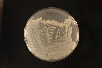 Candida vespimorsuum image