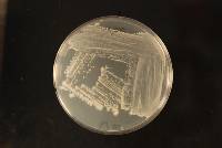 Candida vespimorsuum image