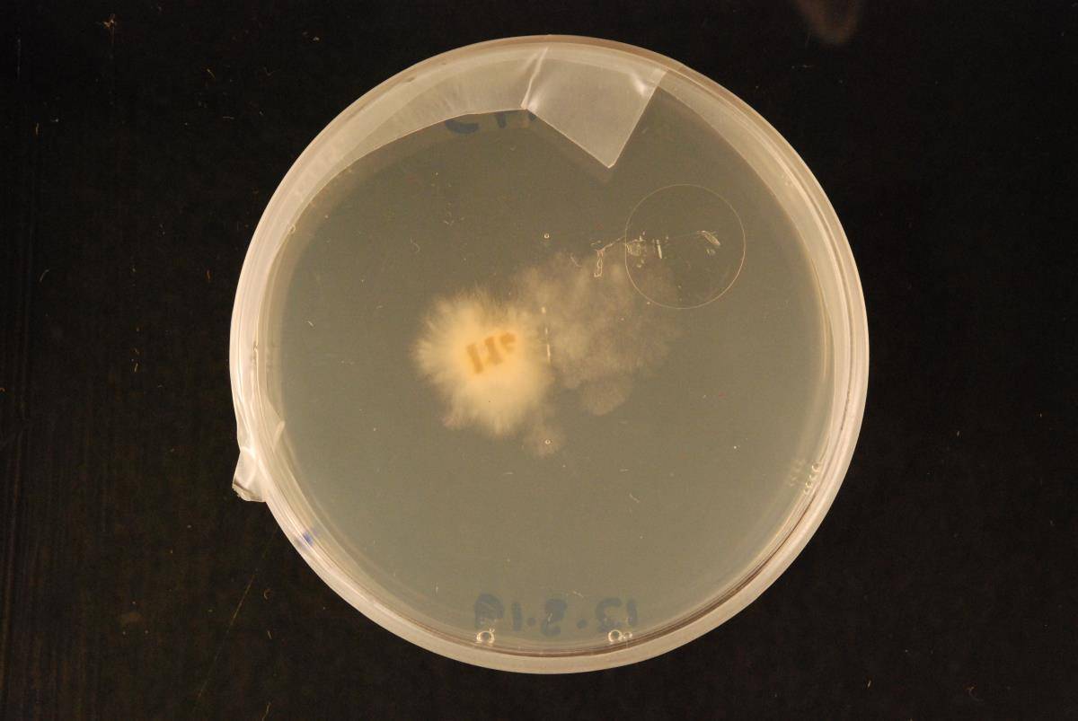 Pestalotiopsis image