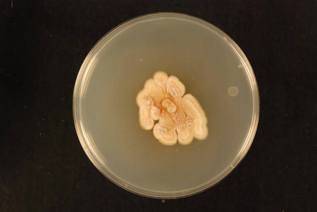 Phaeoacremonium image