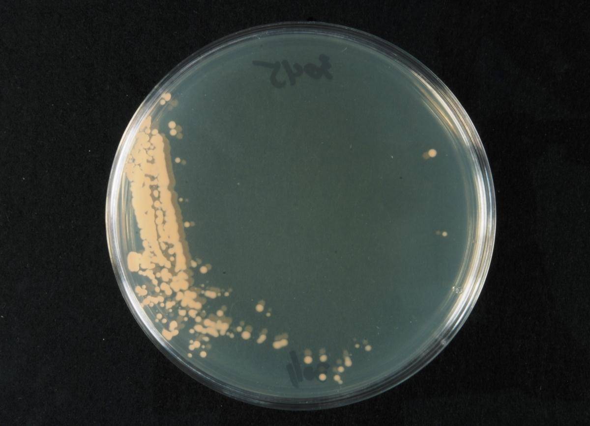 Rhodotorula image