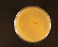 Glomerella cingulata image