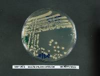 Saccharomyces cerevisiae image