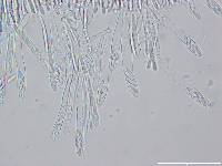Chlorosplenium chlora image