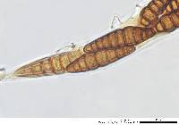 Oedohysterium sinense image