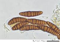 Oedohysterium sinense image