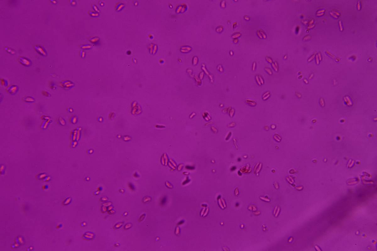 Syzygospora effibulata image