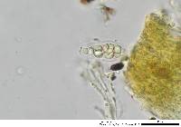 Gloniopsis praelonga image