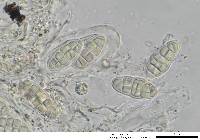 Gloniopsis praelonga image