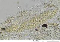 Gloniopsis praelonga image