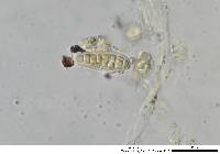 Gloniopsis praelonga image