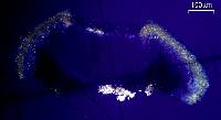 Acarospora socialis image