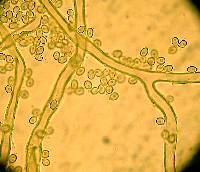 Calvatia pachyderma image