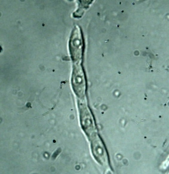 Camillea heterostoma image