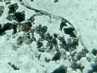 Whalleya microplaca image