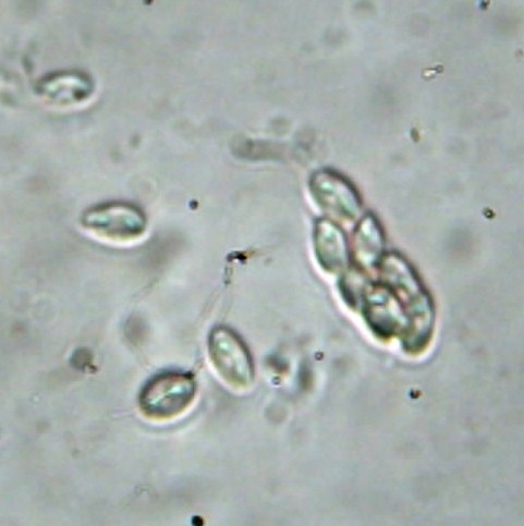 Nitschkia acanthostroma image