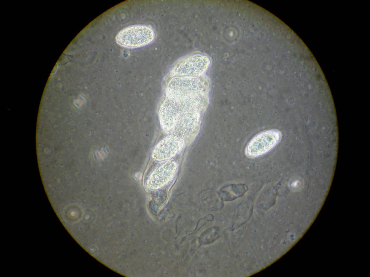 Gelasinospora brevispora image