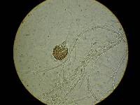 Fusarium equiseti image