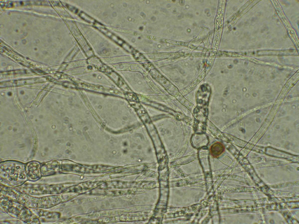 Fusarium equiseti image