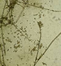Cladosporium sphaerospermum image