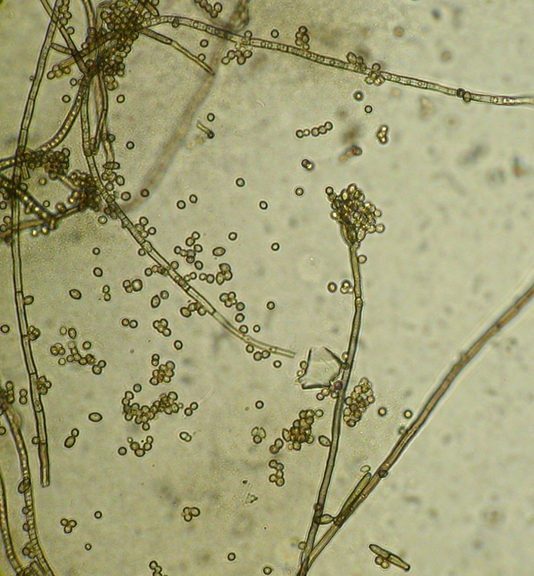 Cladosporium sphaerospermum image