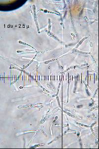 Dacrymyces stillatus image