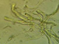 Dacrymyces stillatus image