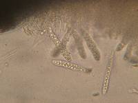 Dencoeliopsis johnstonii image