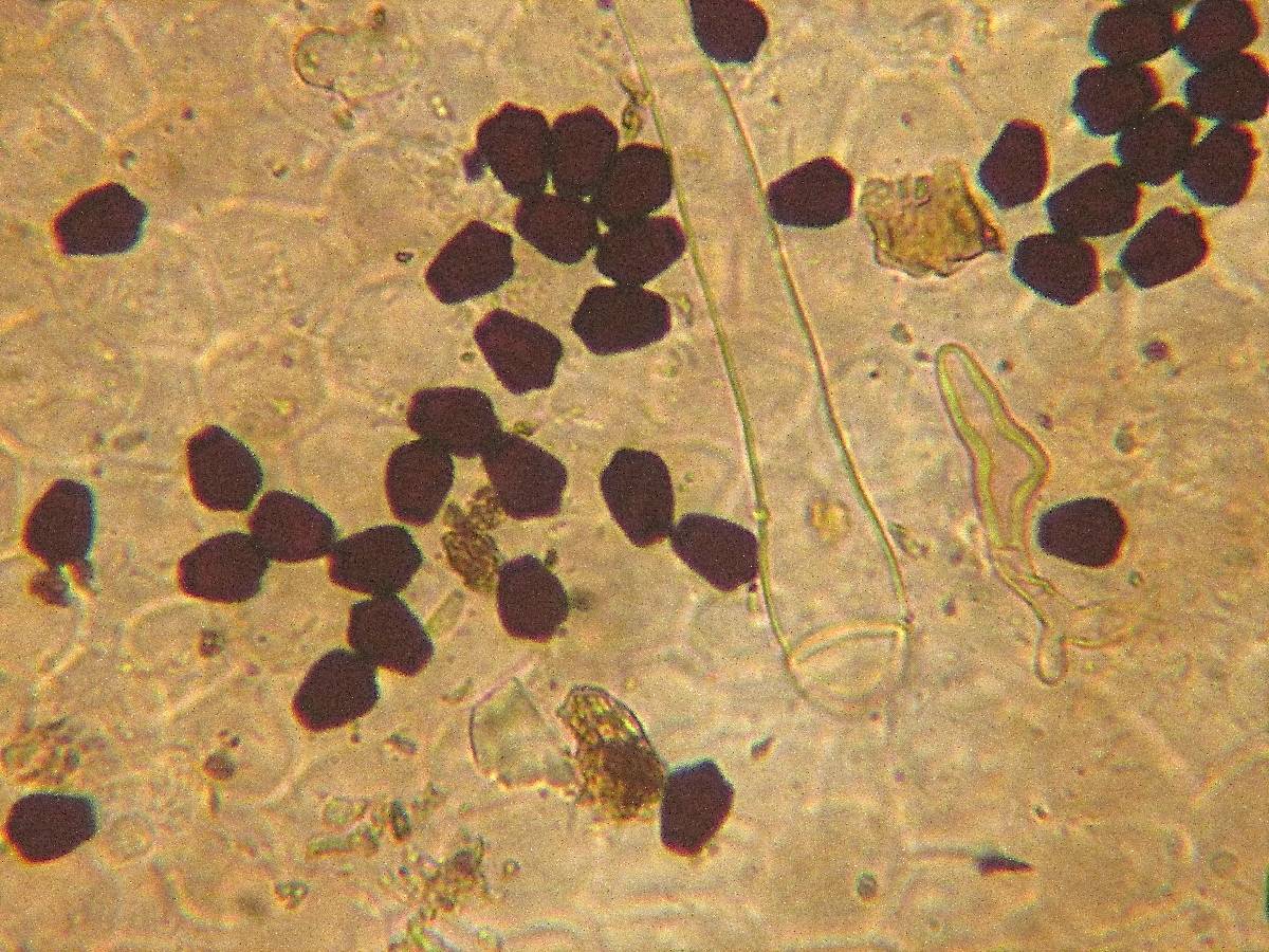 Coprinellus angulatus image
